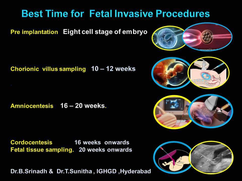 Best Time for Fetal Invasive Procedures