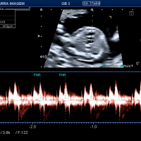 Qual é a frequência cardíaca normal do feto?